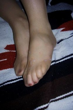 PÉS DELA ESPORRADOS CALÇANDO COLLANTS.jpg