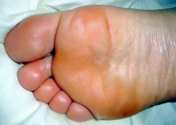 CU Sole.jpeg