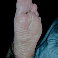 Wonky Toes